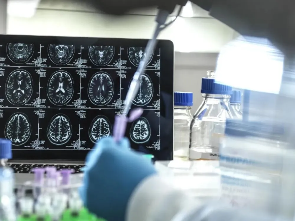 Revisão questiona eficácia de remédios contra o Alzheimer. Entenda