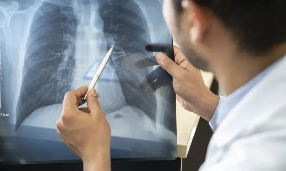 Tabagismo cresce entre jovens de 16 a 24 anos e acende alerta de especialistas